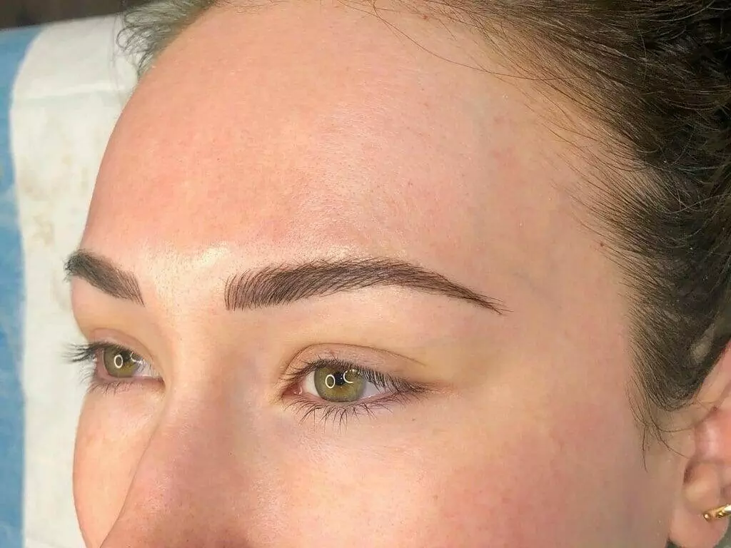 A woman's eyebrows after a Christine Reynolds brow lift.