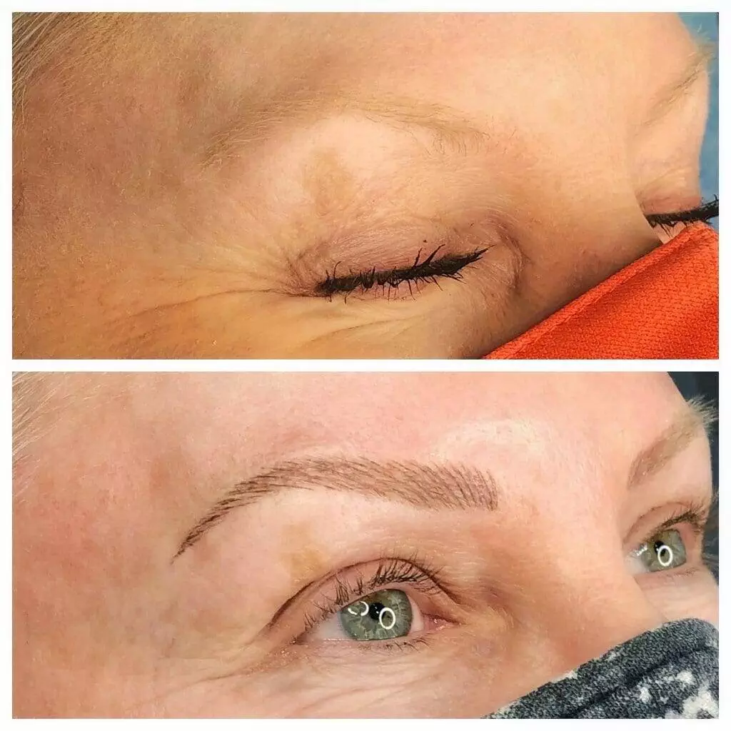 Before and after pictures of Christine Reynolds' eyebrows.