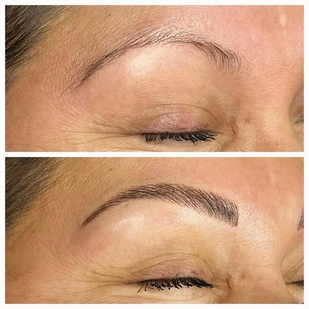 Before and after pictures of Christine Reynolds' eyebrows.