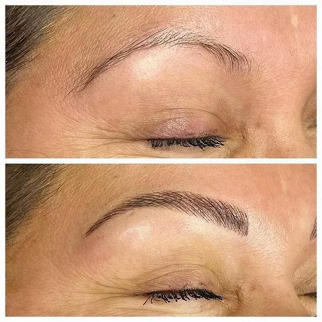 Before and after pictures of Christine Reynolds's eyebrows.