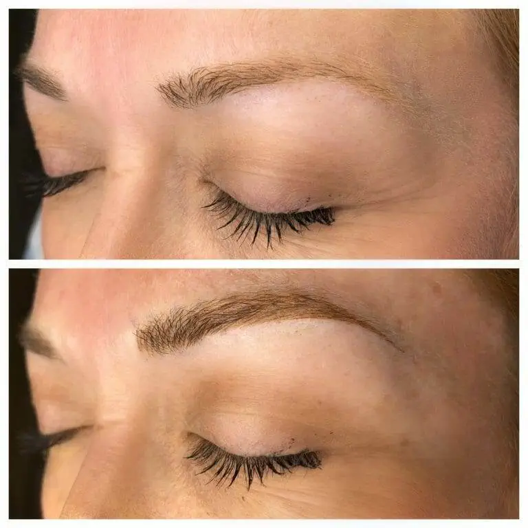 A woman's eyebrows transformed through microblading treatment.