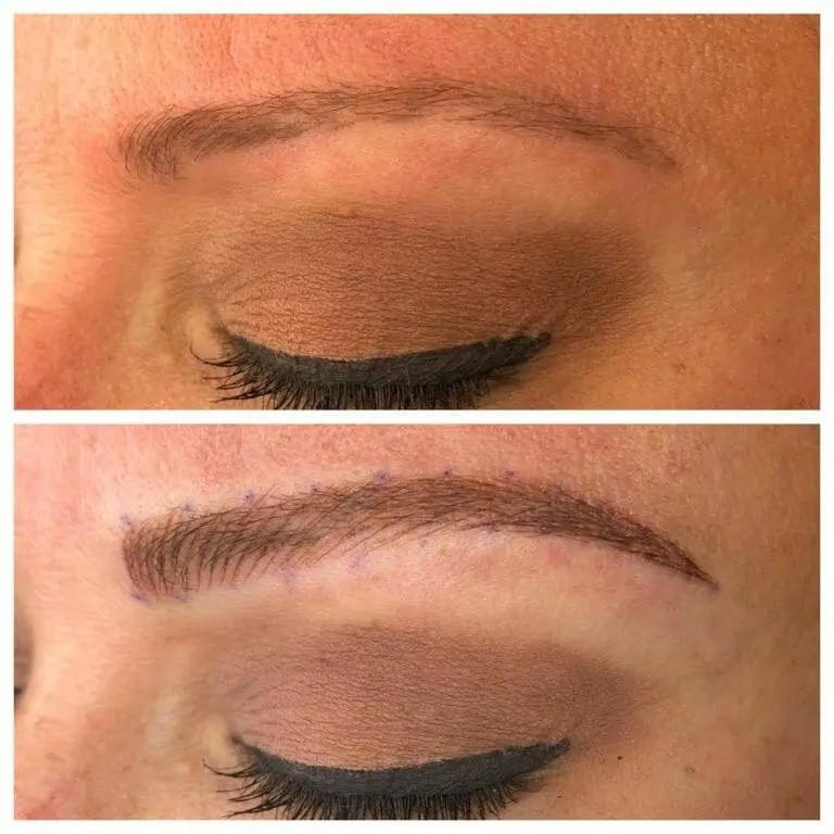 Before and after pictures of a woman's eyebrows enhanced with microblading.
