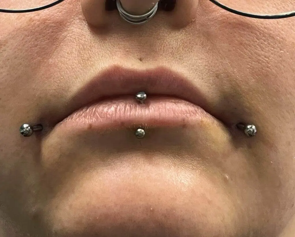 A woman named Ronnie Shaw with piercings on her lips.