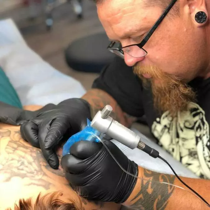 The Ultimate Guide To Non-Laser Tattoo Removal