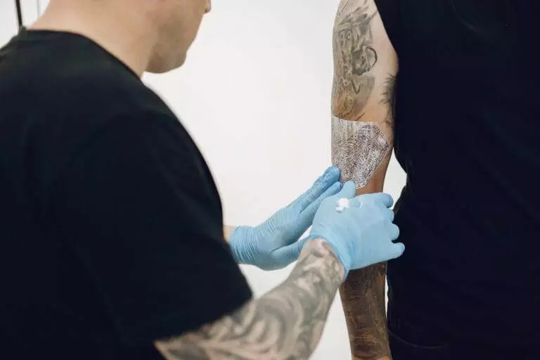 The Natural Way to Say Goodbye to Your Tattoo: Non-Laser Removal Explained