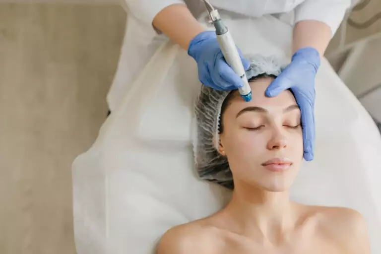 Microneedling 101: Everything You Need to Know at Embellish PB