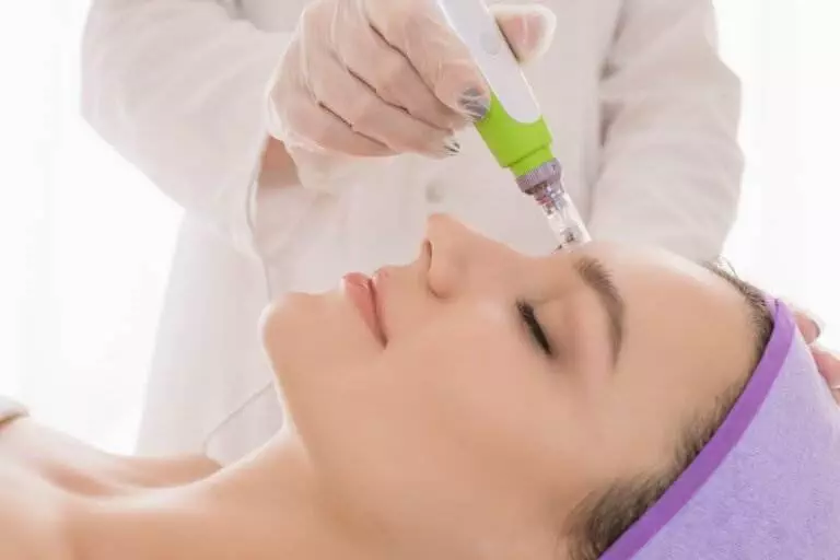 Embellish PB’s Top Tips for Pre and Post-Microneedling Care in PB